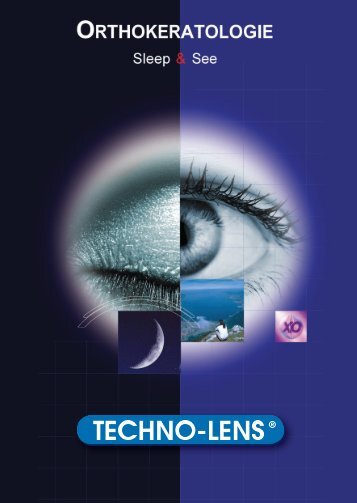 Orthokeratologie sleep & see - TECHNO-LENS Deutschland GmbH