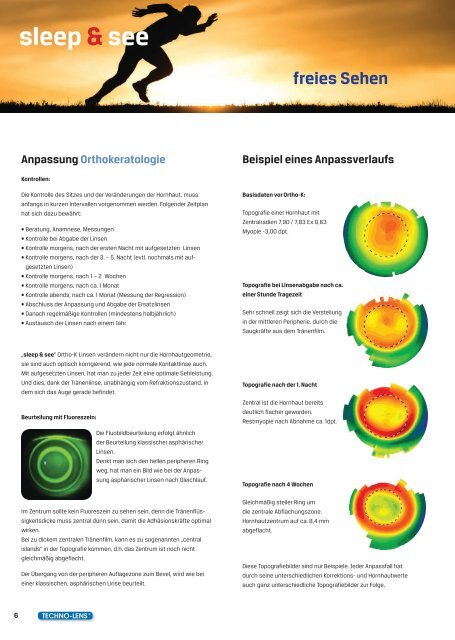 Orthokeratologie sleep & see - TECHNO-LENS Deutschland GmbH