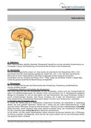 Hydrocephalus