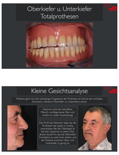 Oberkiefer Für Unterliefer Zu Klein
