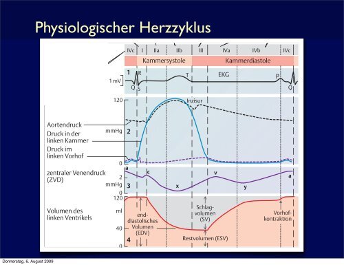 IABP Therapie - Die Basics