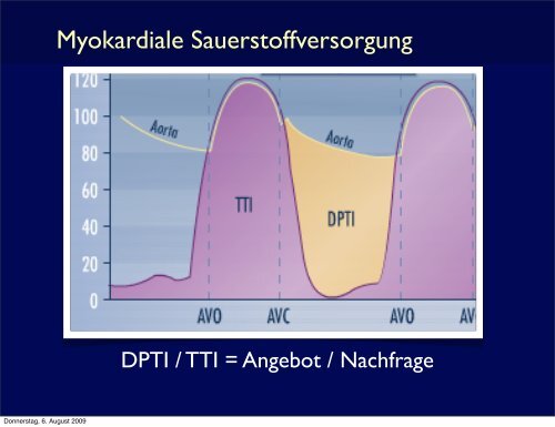 IABP Therapie - Die Basics