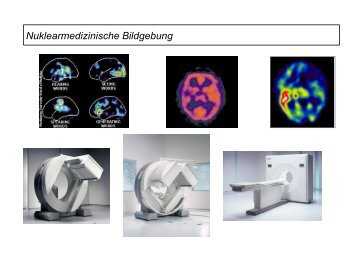 Nuklearmedizinische Bildgebung - Klinik für Epileptologie