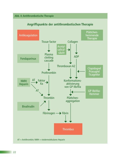 ESC POCKET GUIDELINES - Leitlinien - Deutsche Gesellschaft für ...