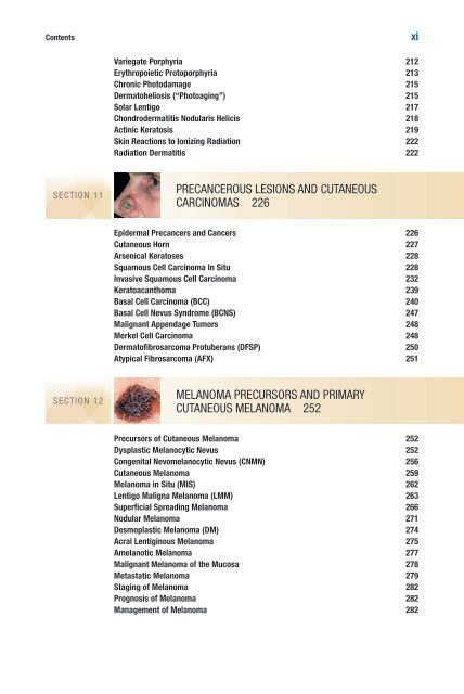 TOC and Sample Chapters - McGraw-Hill Professional