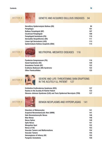 TOC and Sample Chapters - McGraw-Hill Professional