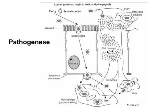 Pseudomonas aeruginosa