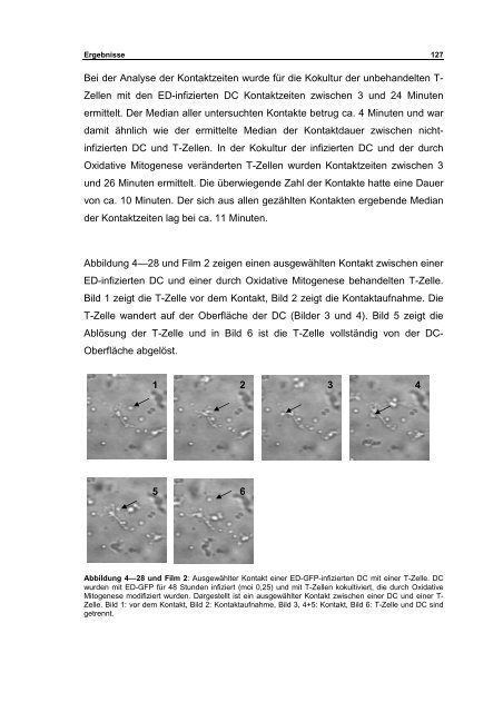 Interaktion von Masernviren mit Dendritischen Zellen - OPUS ...