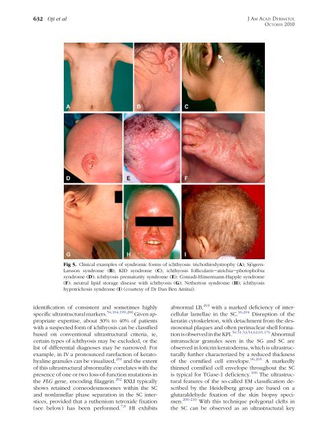 Revised nomenclature and classification of inherited ichthyoses ...