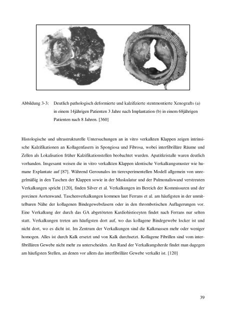 Thesis - RWTH Aachen University