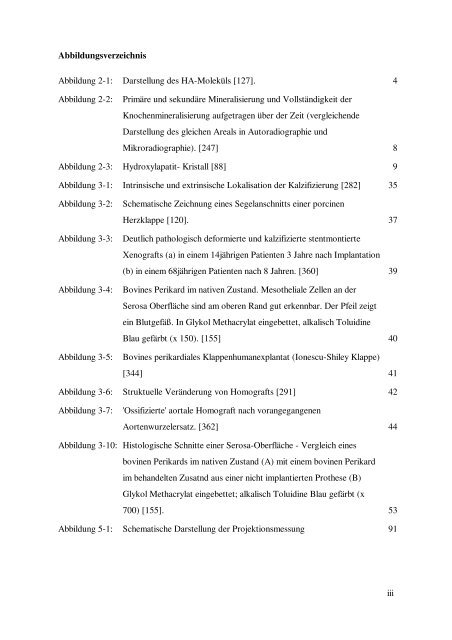 Thesis - RWTH Aachen University