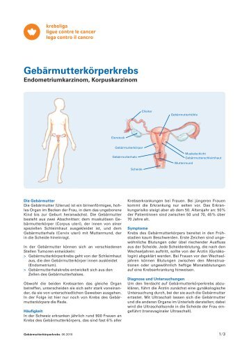 Gebärmutterkörperkrebs - Krebsliga Schweiz