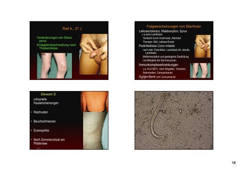 Differentialdiagnose und Therapie von im Ausland erworbenen ...