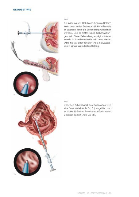 UPDATE September 2012 - Uniklinik Balgrist