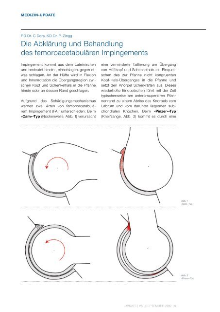 UPDATE September 2012 - Uniklinik Balgrist