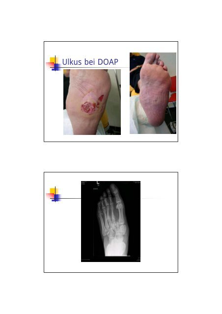 Interdisziplinäre Therapie des Diabetes - Bayer Diabetes Care ...