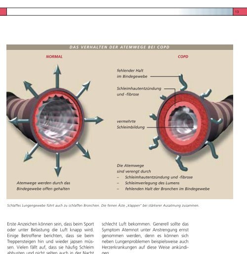 Hilfe Atemnot - COPD