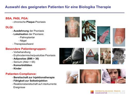 Biologika in der Praxis - Dermatologische Praxis und Haarcenter ...