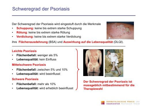 Biologika in der Praxis - Dermatologische Praxis und Haarcenter ...