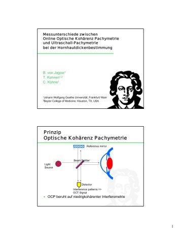 Prinzip Optische Kohärenz Pachymetrie