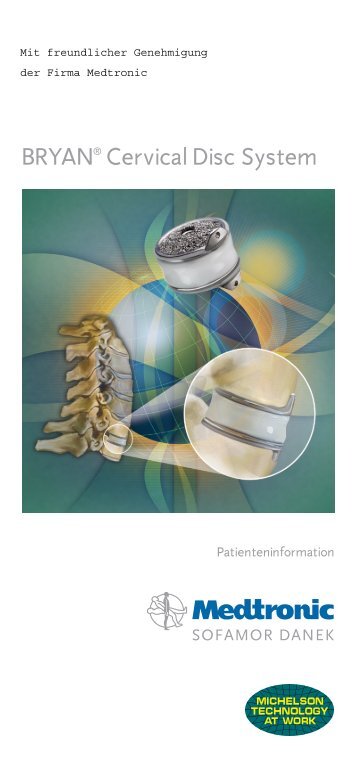 BRYAN® Cervical Disc System - Die Bandscheibe