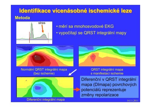 Měření elektrického pole srdce - FBMI