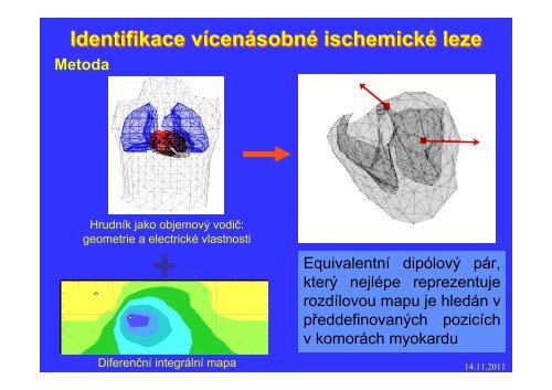 Měření elektrického pole srdce - FBMI