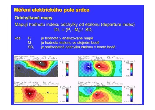 Měření elektrického pole srdce - FBMI