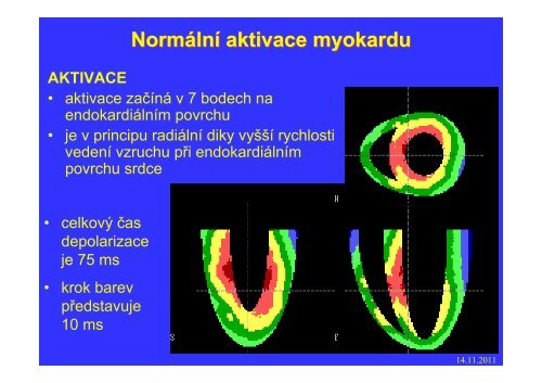 Měření elektrického pole srdce - FBMI