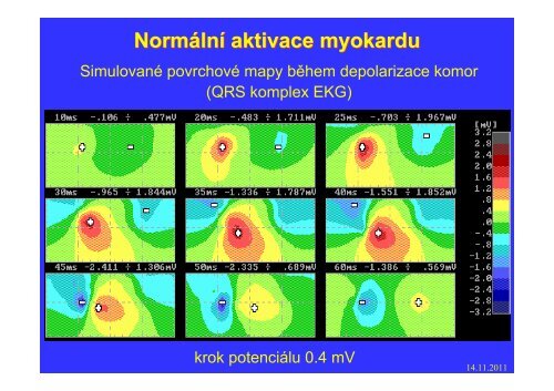 Měření elektrického pole srdce - FBMI