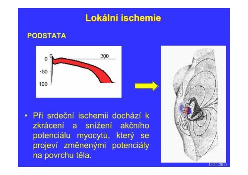 Měření elektrického pole srdce - FBMI