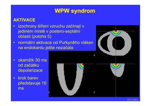 Měření elektrického pole srdce - FBMI