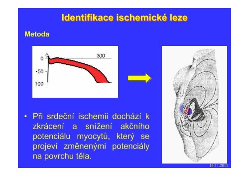 Měření elektrického pole srdce - FBMI