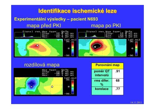 Měření elektrického pole srdce - FBMI