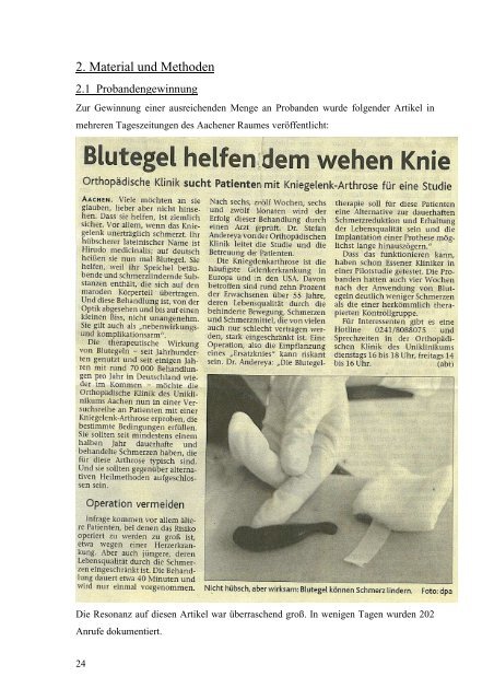 Der Einsatz von Blutegeln zur symptomatischen Schmerztherapie bei