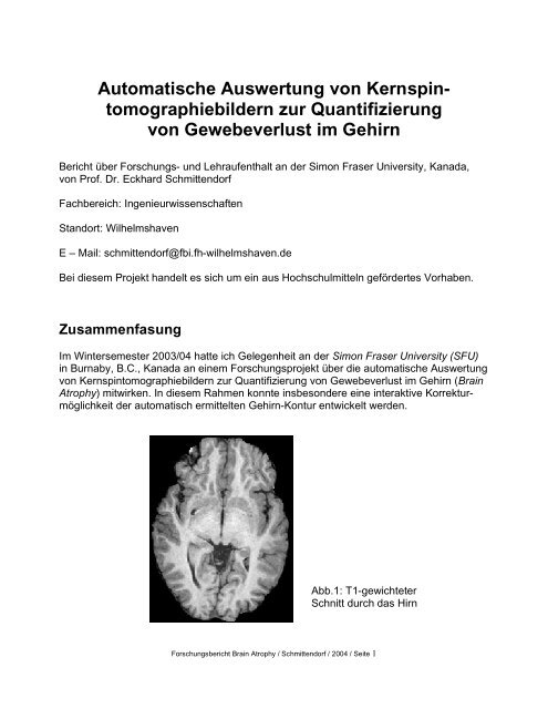 Automatische Auswertung von Kernspin- tomographiebildern zur ...