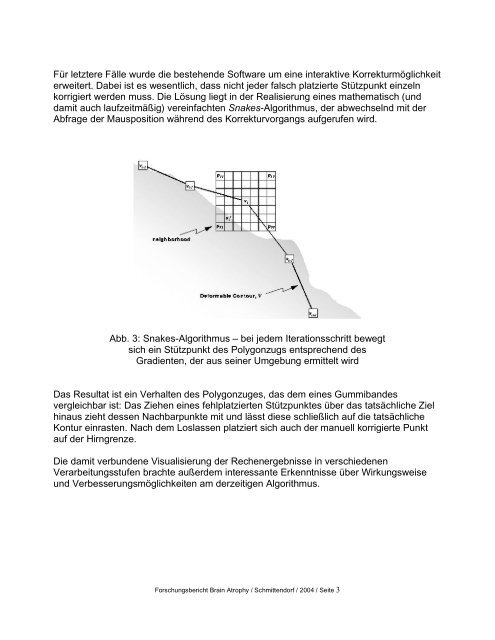 Automatische Auswertung von Kernspin- tomographiebildern zur ...