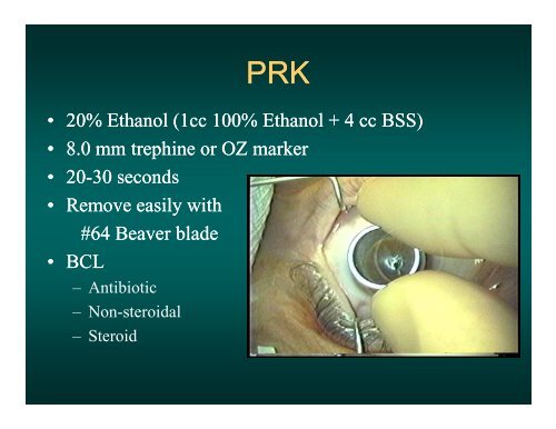 Dealing with The Refractive Surprise - PDF