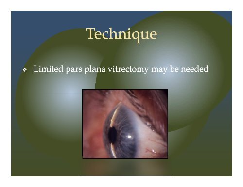 Cataract Surgery in Small Eyes