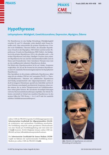 Hypothyreose - Fortbildung - UniversitätsSpital Zürich