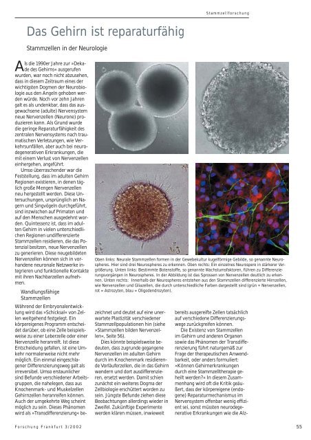 Das Gehirn ist reparaturfähig - Forschung Frankfurt - Goethe ...