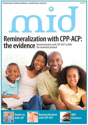 Remineralization with CPP-ACP: - GC Europe