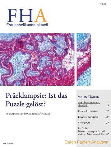 Präeklampsie: Ist das Puzzle gelöst? - Frauenheilkunde aktuell