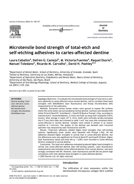Microtensile bond strength of total-etch and self-etching adhesives ...