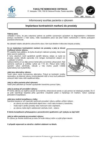 Implantace kontrastních markerů do prostaty - Fakultní nemocnice ...