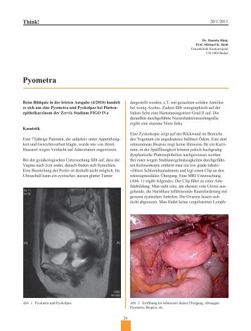 Pyometra - Frauenheilkunde aktuell