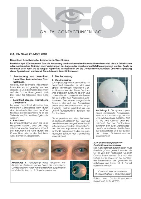 03_März 2007.pdf - Galifa Contactlinsen AG