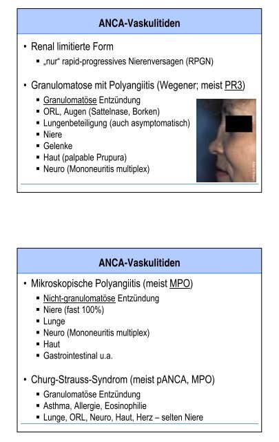 Glomerulopathien - Fortbildung