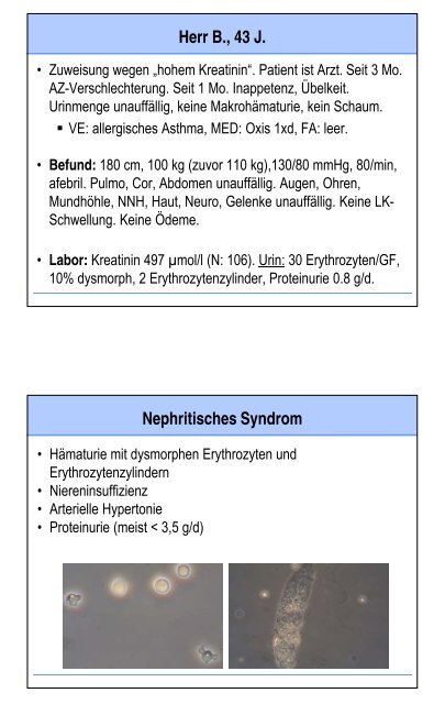 Glomerulopathien - Fortbildung