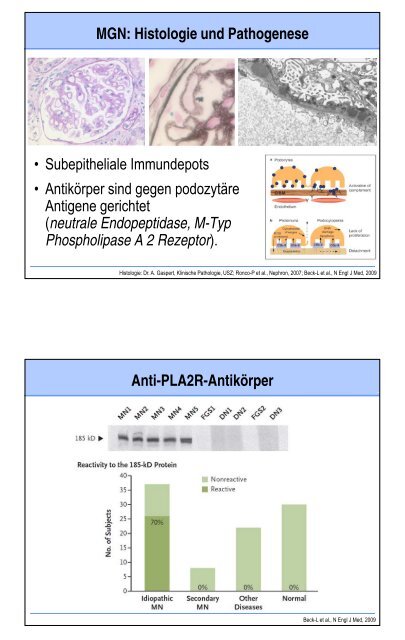 Glomerulopathien - Fortbildung